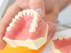 歯周病のおもな基本治療